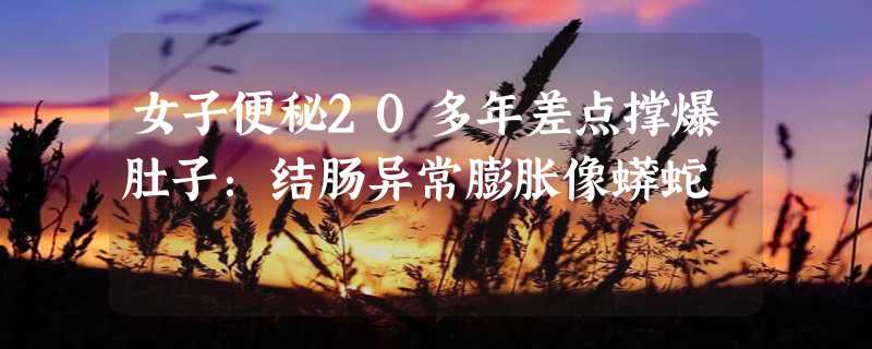 女子便秘20多年差点撑爆肚子：结肠异常膨胀像蟒蛇